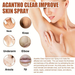 30ml Acantho Clear Spray Dark Spot Correction Improve Skin Texture