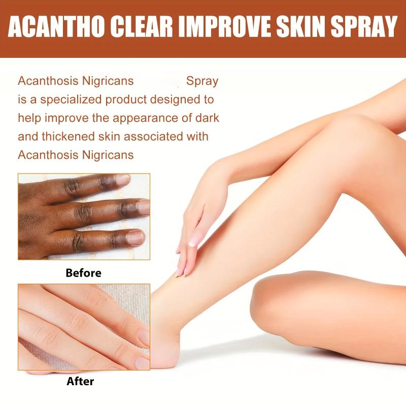 30ml Acantho Clear Spray Dark Spot Correction Improve Skin Texture