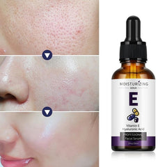 Vitamin E Serum with Hyaluronic Acid for Smooth Skin Tone Hydration 30ml