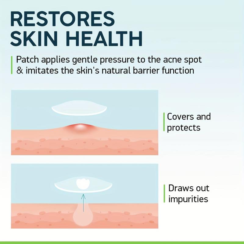 Acne Pimple Patches For Daily & Night Skin Care
