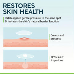 Acne Pimple Patches For Daily & Night Skin Care