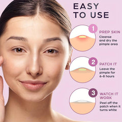 Acne Pimple Patches For Daily & Night Skin Care