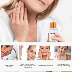 17 ml Niacinamide Serum to Brighten Skin and Fade Acne Marks