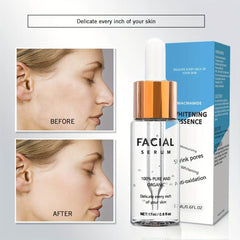 17 ml Niacinamide Serum to Brighten Skin and Fade Acne Marks