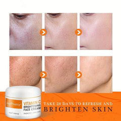 50ml Vitamin C Face Cream Acne Pimple Mark Removal Dark Spots Mask