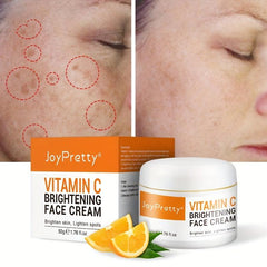 50ml Vitamin C Face Cream Acne Pimple Mark Removal Dark Spots Mask