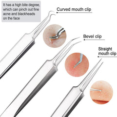 Professional Blackhead Remover Kit for Face and Nose