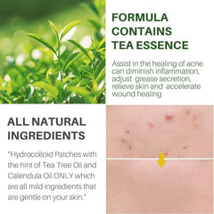 72 Pcs Pimple Patches Hydrocolloid Acne Stickers For Covering Zits Blemishes