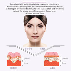 3pcs V Shaped Face Mask For Edema Reduction