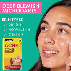 Acne Pimple Patch 540 Pcs Vegan Friendly