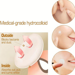 Acne Pimple Patch 540 Pcs Vegan Friendly