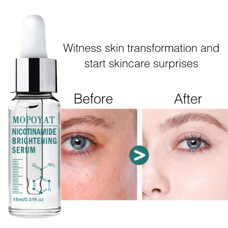 Niacinamide Essence for Brighter Skin