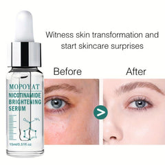 Niacinamide Essence for Brighter Skin