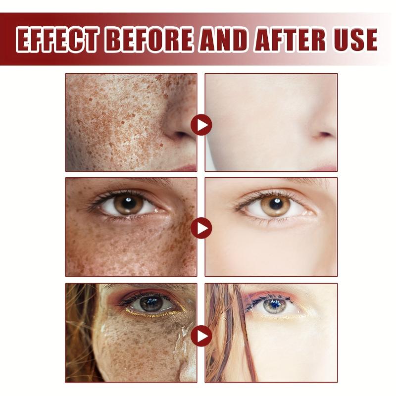 50g Nicotinamide Face Cream - Moisturizing and Even Skin Tone