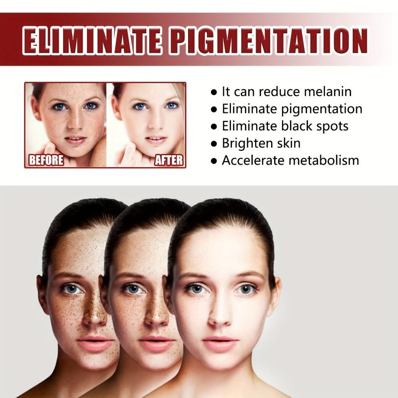 50g Nicotinamide Face Cream - Moisturizing and Even Skin Tone