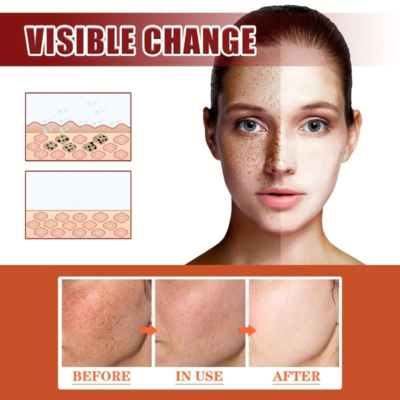 50g Nicotinamide Face Cream - Moisturizing and Even Skin Tone
