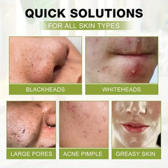 60g Blackhead Pore Cleansing Mask Deep Cleansing