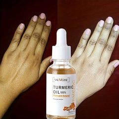 Turmeric Dark Spot Fade Serum for All Skin Types