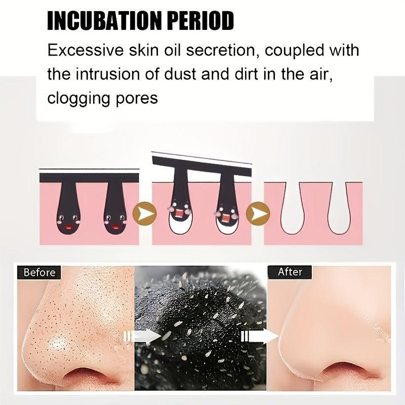 200 Pcs Blackhead Nose Strips Deep Cleansing Nasal Spot Stickers