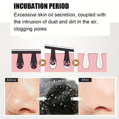 200 Pcs Blackhead Nose Strips Deep Cleansing Nasal Spot Stickers