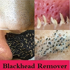 200 Pcs Blackhead Nose Strips Deep Cleansing Nasal Spot Stickers