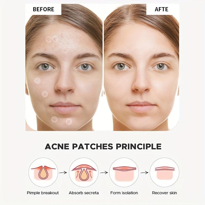 15pcs Acne Cover Patch Natural Acne Sticker Thin Breathable Acne Patch