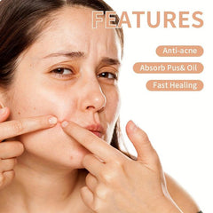 15pcs Acne Cover Patch Natural Acne Sticker Thin Breathable Acne Patch