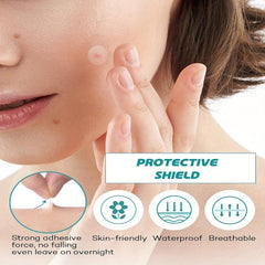 Acne Covering Sticker Invisible Makeup Acne Patch Skin Care - 144pcs