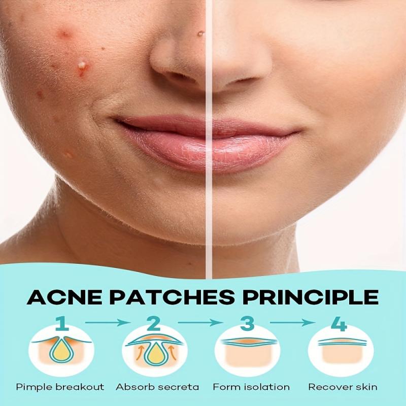 Acne Covering Sticker Invisible Makeup Acne Patch Skin Care - 144pcs