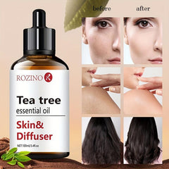 Tea Tree Essential Oil 100% Natural Organic for Skin Care