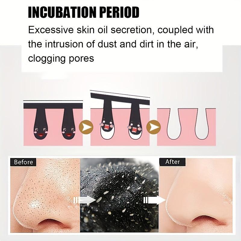 20Pcs Blackhead Nose Strips Deep Cleanse for Acne Prevention