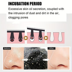 20Pcs Blackhead Nose Strips Deep Cleanse for Acne Prevention