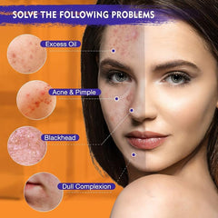 Turmeric Mud Mask with Vitamin C for Even Skin Tone Clean Up Blackhead Dirt