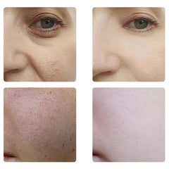 Retinol Moisturizer 200ml Aging-Resisting Facial Cream