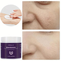 Retinol Moisturizer 200ml Aging-Resisting Facial Cream