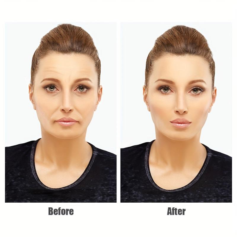 5pcs Silicone Wrinkle Patch Forehead & Cheek Lifting Sticker