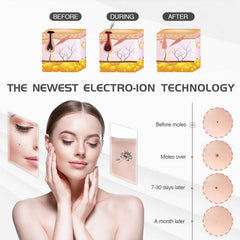 Dark Spot Remover Needles For Laser Plasma Pen