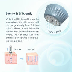 Adjustable 0.25-1.5mm HN24 Titanium Microneedle Hyaluronic Acid Stamp