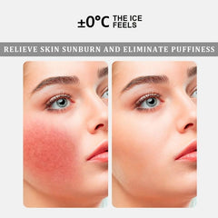 Ice Roller Mold For Face Ice Face Roller For Skin Care