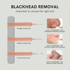 Stainless Steel Blackhead Remover Tool with Tweezers
