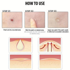 Invisible Acne Pimple Patches 36 180 Patches Reduce Blemishes Inflammation
