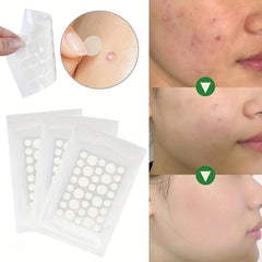 Invisible Acne Pimple Patches 36 180 Patches Reduce Blemishes Inflammation