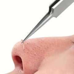 Safety Pimple Popper Tool Stainless Steel Needle For Women