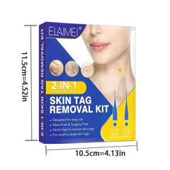 2-in-1 Wart & Acne Removal Kit - Fast & Effective Skin Tag Care