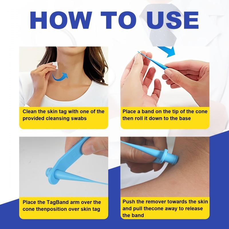2-in-1 Wart & Acne Removal Kit - Fast & Effective Skin Tag Care