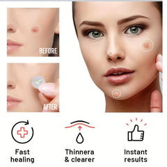 36pcs Acne Pimple Patches Hydrocolloid Heart & Stars Shape Stickers