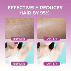 Crystal Hair Eraser For Women And Men - Hair Removal Tool
