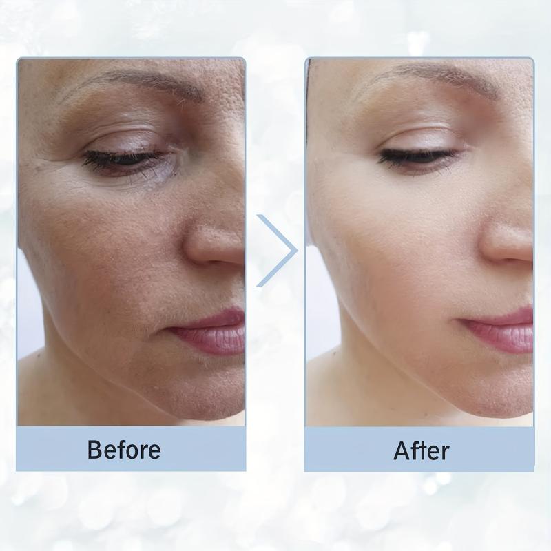 Microdermabrasion Machine for Skin Care Face Neck Arms Legs Body