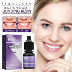 Tooth Gem Glue 7mL Bottle for DIY Teeth Rhinestone Decoration