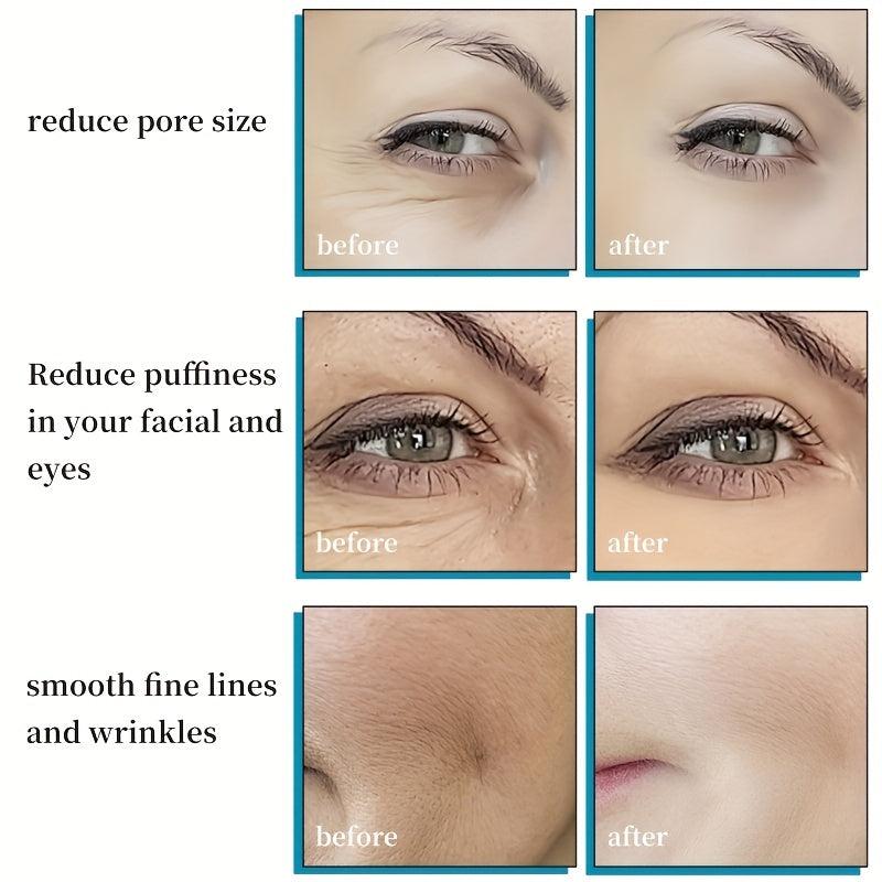 Facial Ice Roller & Globes Set for Puffiness & Dark Circles